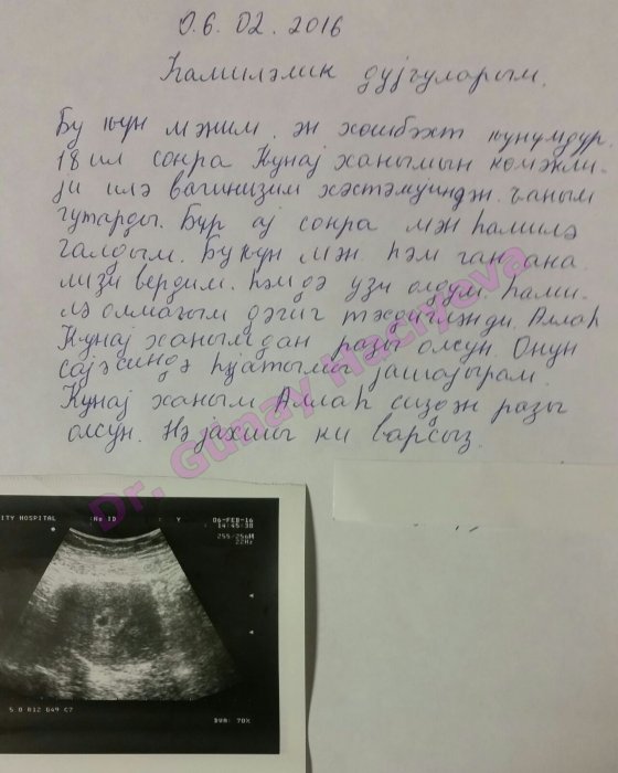Zaqataladan 18 ilin vaginizmi