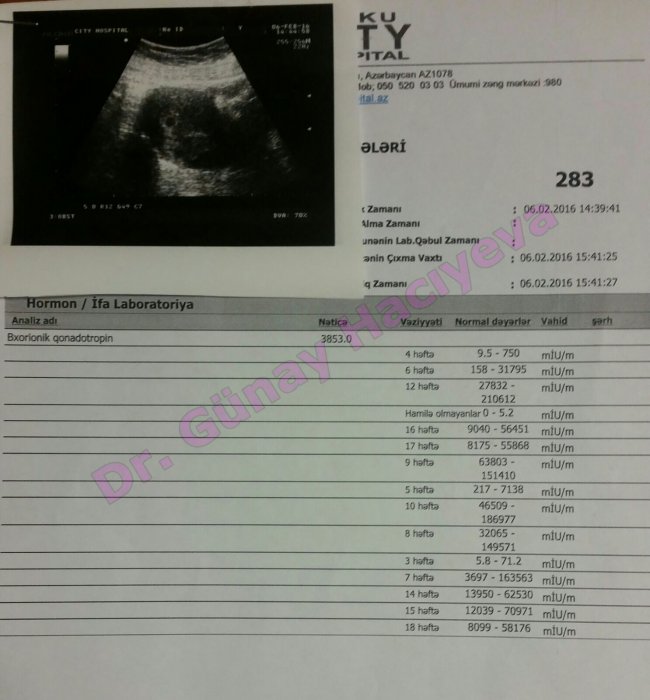 Zaqataladan 18 ilin vaginizmi